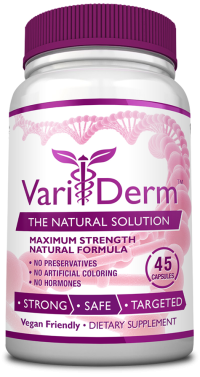 Varicose Vein Remedy